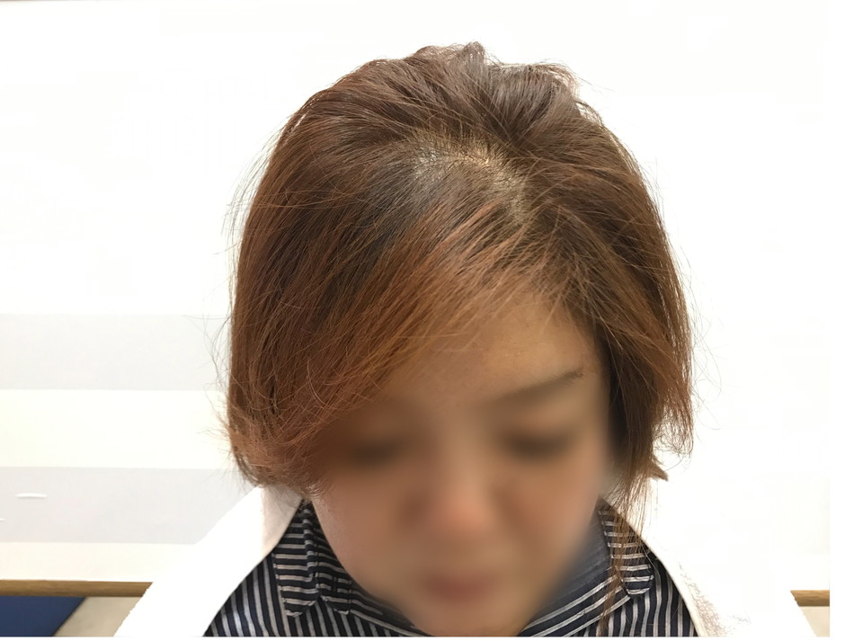 ヘアループ　兵庫